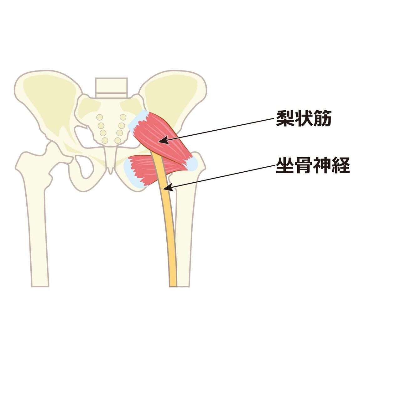 梨状筋症候群でお困りの方は、こちらです。